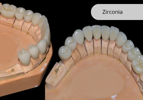 zirconia-1-300x200